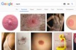 Screenshot-2017-12-28 nipple - Поиск в Google.png