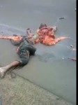 Traffic Accident Victim Reduced to Guts and Two Limbs  Best[...].mp4