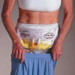Rusch Belly Bag Urinary Drainage Bag3146.jpg