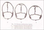 rasa35.jpg