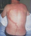 lightning-strike-scar-lichtenberg-figure-11.jpg