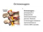 grudnoj-osteoxondroz-lechenie-v-domashnix-usloviyax[1].jpg