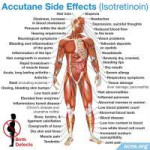 04-side-effects-of-accutane-isotretinoin.jpg.21ba5567cceda7[...].jpg