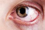 depositphotos6071250-stock-photo-blood-capillary-human-eye.jpg