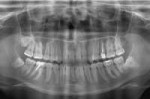 Панорамный снимок зубов.jpg