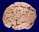 220px-Brain090407.jpg