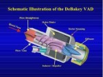 development-of-an-axial-flow-left-ventricular-assist-device[...].jpg