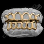 Affordable-Solid-Gold-Open-Face-Grillz-Img-1760x.jpg.jpg