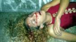 young-woman-perform-agonal-breathing-death-headshot-wound.jpg