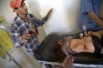 girl-gravely-injured-during-bombardment-jarjanaz-syria.jpg