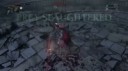 Bloodborne™20170813015839Segment0VP8