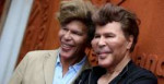 bogdanoff-brothers-plastic-surgery-1-1.jpg