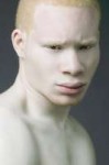 albino-1900x2850c.jpg