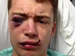 man-beaten-with-beer-bottle-was-it-because-hes-gayx750.jpg