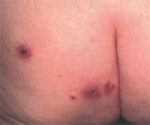 atlderm059.jpg