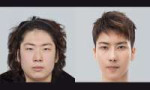 korean-plastic-surgery-16-copy.jpg