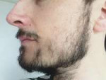 Patchy-Neck-Beard.jpg.webp