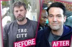 Ben-Affleck-before-and-after-plastic-su.jpg