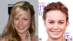 Brie-Larson-before-and-after-plastic-surgery-16.jpg