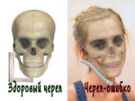 Череп.jpg