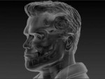 arnold side x ray.jpg