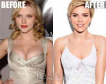 scarlett-johansson-breast-reduction.jpg