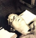 JFK-autopsy.jpg