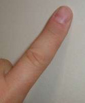 200px-Finger.agr.jpg