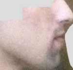 chin.jpg